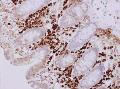 Immunohistochemistry-Paraffin: Proapoptotic Caspase Adaptor Protein Antibody [NBP1-31619]