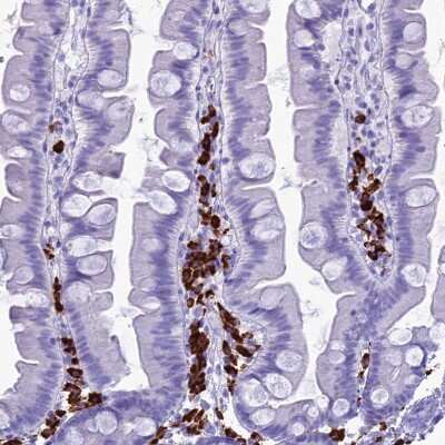 Immunohistochemistry-Paraffin: Proapoptotic Caspase Adaptor Protein Antibody [NBP1-92287]