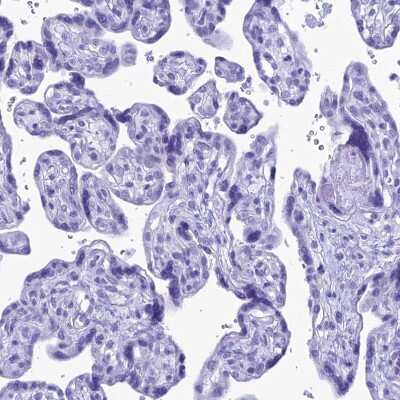 Immunohistochemistry-Paraffin: Proapoptotic Caspase Adaptor Protein Antibody [NBP1-92287]