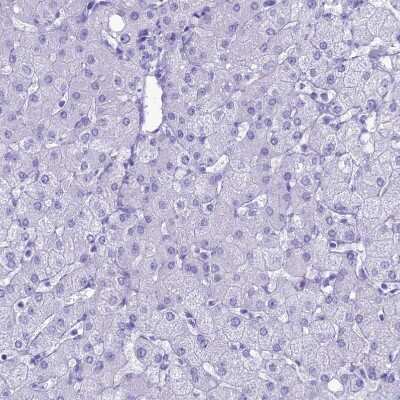 Immunohistochemistry-Paraffin: Proapoptotic Caspase Adaptor Protein Antibody [NBP1-92287]