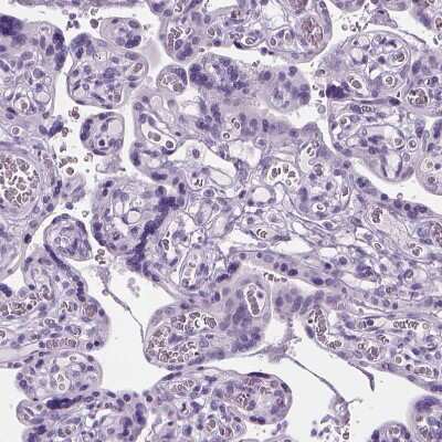 Immunohistochemistry-Paraffin: Proapoptotic Caspase Adaptor Protein Antibody [NBP2-55874]
