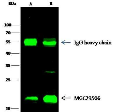 Immunoprecipitation: Proapoptotic Caspase Adaptor Protein Antibody [NBP2-97099]