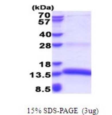 SDS-PAGE: Recombinant Human Proapoptotic Caspase Adaptor Protein His Protein [NBP2-51645]