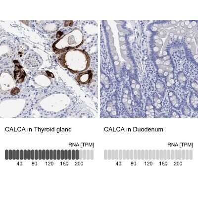 Immunocytochemistry/ Immunofluorescence: Procalcitonin Antibody [NBP3-16983]