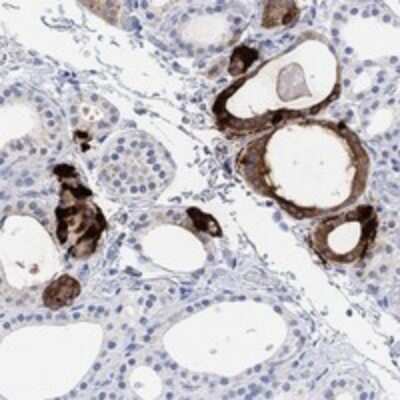 Immunohistochemistry-Paraffin: Procalcitonin Antibody [NBP3-16983]