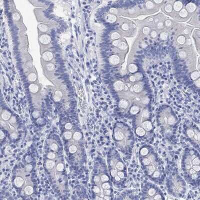 Immunohistochemistry-Paraffin: Procalcitonin Antibody [NBP3-16983]