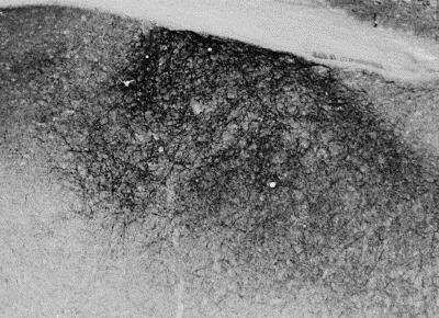 Immunohistochemistry-Frozen: Proenkephalin Antibody [NBP1-20963]