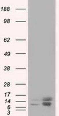 Western Blot: Profilin 1 Antibody (OTI1D5) [NBP2-02577]