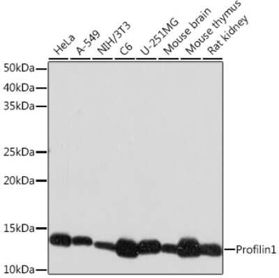 Western Blot: Profilin 1 Antibody (2Z1M4) [NBP3-16780]