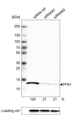 Western Blot: Profilin 1 Antibody (CL3524) [NBP2-59778]