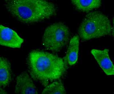 Immunocytochemistry/ Immunofluorescence: Profilin 1 Antibody (JA30-13) [NBP2-67078]