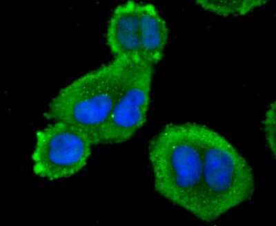 Immunocytochemistry/ Immunofluorescence: Profilin 1 Antibody (JA30-13) [NBP2-67078]