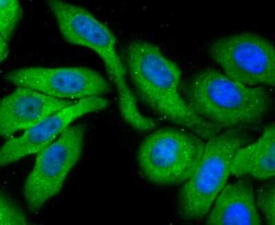 Immunocytochemistry/ Immunofluorescence: Profilin 1 Antibody (JA30-13) [NBP2-67078]