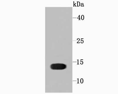 Western Blot: Profilin 1 Antibody (JA30-13) [NBP2-67078]