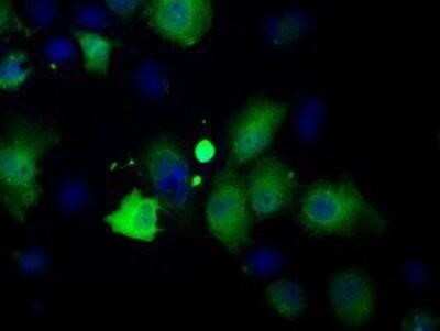 Immunocytochemistry/ Immunofluorescence: Profilin 1 Antibody (OTI1D5) - Azide and BSA Free [NBP2-73605]