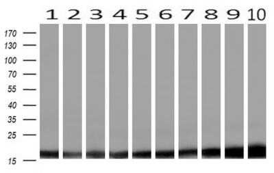 Western Blot: Profilin 1 Antibody (OTI1D5)Azide and BSA Free [NBP2-73605]