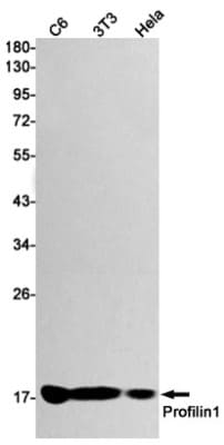 Western Blot: Profilin 1 Antibody (S06-6H7) [NBP3-19483]