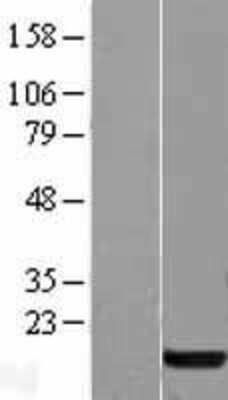 Western Blot: Profilin 1 Overexpression Lysate [NBL1-14318]