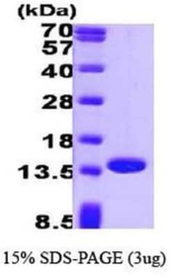 SDS-PAGE: Recombinant Human Profilin 1 Protein [NBP1-30215]