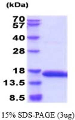 SDS-PAGE: Recombinant Rat Profilin 1 His Protein [NBP2-52175]