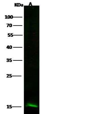 Western Blot: Profilin 2 Antibody (010) [NBP2-90284]