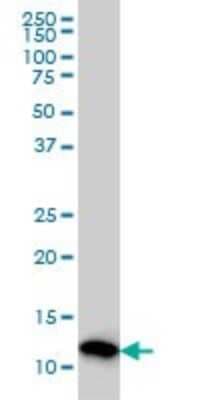 Western Blot: Profilin 2 Antibody (5F11) [H00005217-M04]