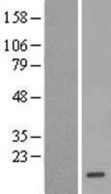 Western Blot: Profilin 2 Overexpression Lysate [NBL1-14320]