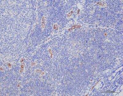 Immunohistochemistry-Paraffin: Progesterone Antibody (6-5E-10B) [NBP2-45210]