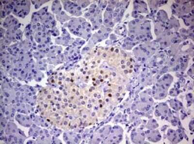 Immunohistochemistry: Progesterone R/NR3C3 Antibody (OTI11E8) [NBP2-46388]