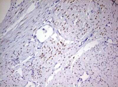 Immunohistochemistry: Progesterone R/NR3C3 Antibody (OTI11E8) [NBP2-46388]