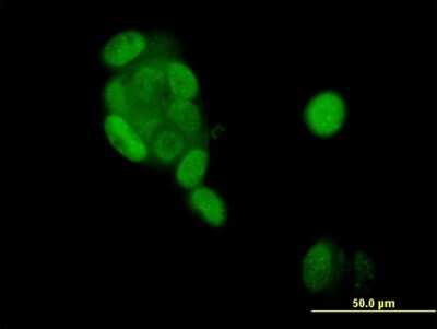 Immunocytochemistry/ Immunofluorescence: Progesterone R/NR3C3 Antibody (4E9) [H00005241-M08]
