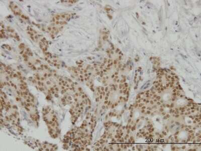Immunohistochemistry-Paraffin: Progesterone R/NR3C3 Antibody (4E9) [H00005241-M08]