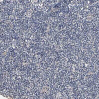 Immunohistochemistry-Paraffin: Progesterone R/NR3C3 Antibody [NBP1-87774]