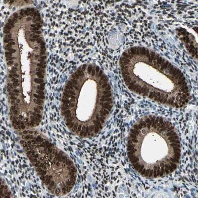 Immunohistochemistry-Paraffin: Progesterone R/NR3C3 Antibody [NBP1-87776]