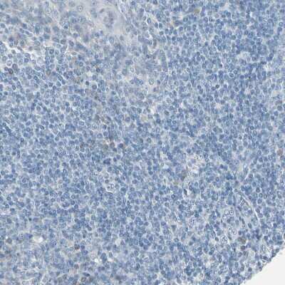 Immunohistochemistry-Paraffin: Progesterone R/NR3C3 Antibody [NBP1-87776]