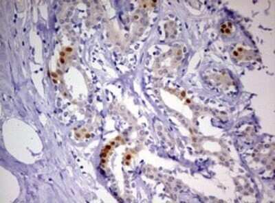 Immunohistochemistry: Progesterone R/NR3C3 Antibody (OTI11E8) - Azide and BSA Free [NBP2-73607]