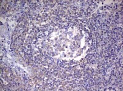 Immunohistochemistry: Progesterone R/NR3C3 Antibody (OTI11E8) - Azide and BSA Free [NBP2-73607]
