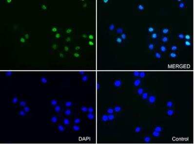 Immunocytochemistry/ Immunofluorescence: Progesterone R/NR3C3 Antibody (OTI11E8) [NBP2-46388]