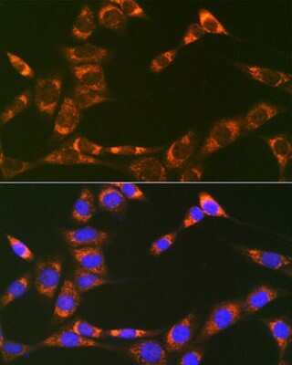 Immunocytochemistry/ Immunofluorescence: Prohibitin 2 Antibody (8I10B1) [NBP3-16766]