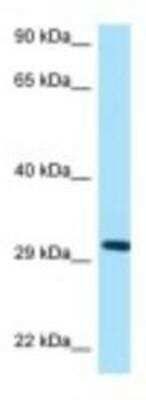 Western Blot: Prohibitin 2 Antibody [NBP1-98312]
