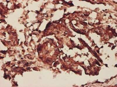 Immunohistochemistry-Paraffin: Prohibitin Antibody (3F4-2B2) [H00005245-M01]