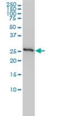 Western Blot: Prohibitin Antibody (3F4-2B2) [H00005245-M01]