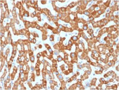 Immunohistochemistry-Paraffin: Prohibitin Antibody (PHB/1881) [NBP3-07816]