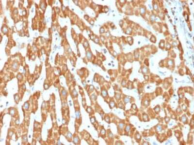 Immunohistochemistry-Paraffin: Prohibitin Antibody (PHB/1882) - Azide and BSA Free [NBP3-08723]