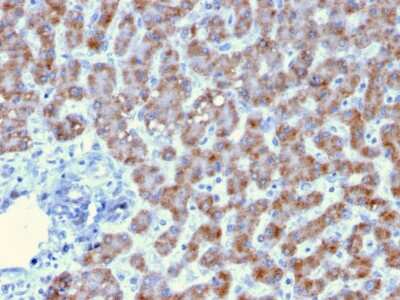 Immunohistochemistry-Paraffin: Prohibitin Antibody (PHB/3193) - Azide and BSA Free [NBP3-08724]