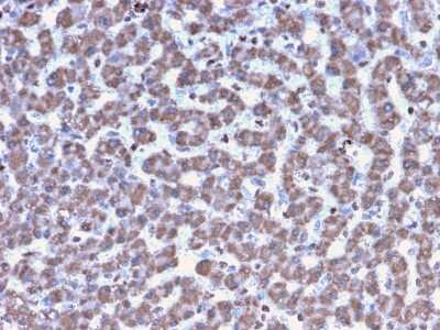 Immunohistochemistry-Paraffin: Prohibitin Antibody (PHB/3194) [NBP3-07841]