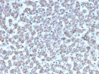 Immunohistochemistry-Paraffin: Prohibitin Antibody (PHB/3194) - Azide and BSA Free [NBP3-08752]