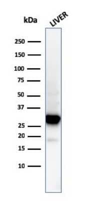 Western Blot: Prohibitin Antibody (PHB/3194) [NBP3-07841]