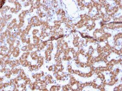 Immunohistochemistry-Paraffin: Prohibitin Antibody (PHB/3225) - Azide and BSA Free [NBP2-79883]