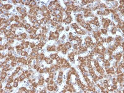 Immunohistochemistry-Paraffin: Prohibitin Antibody (PHB/3226) - Azide and BSA Free [NBP3-08754]